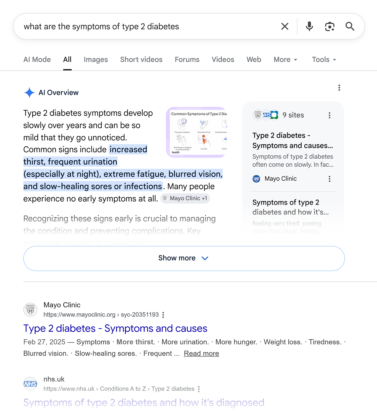 google serp type 2 diabetes symptoms